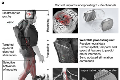 Brain and spine implants restore movement in man paralyzed by accident: ScienceAlert