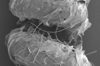 This artificial muscle moves things on its own