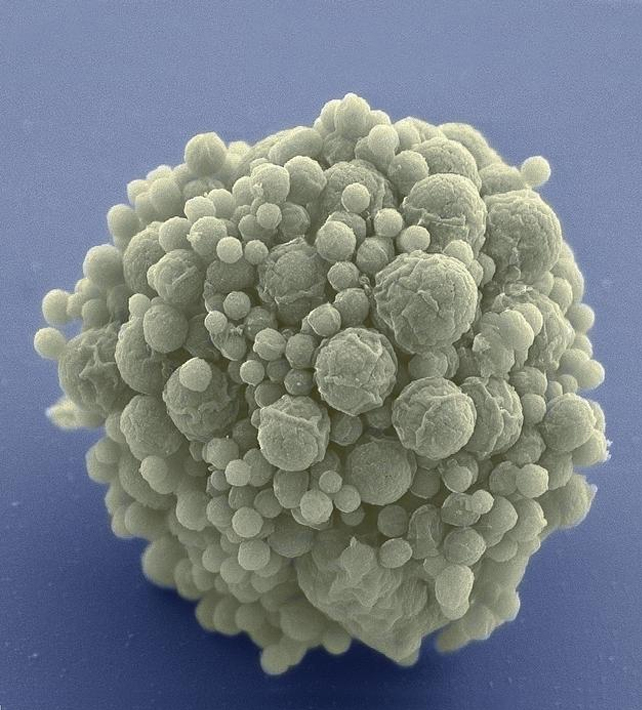 The simplest synthetic cells have been seen to evolve faster than natural cells: ScienceAlert