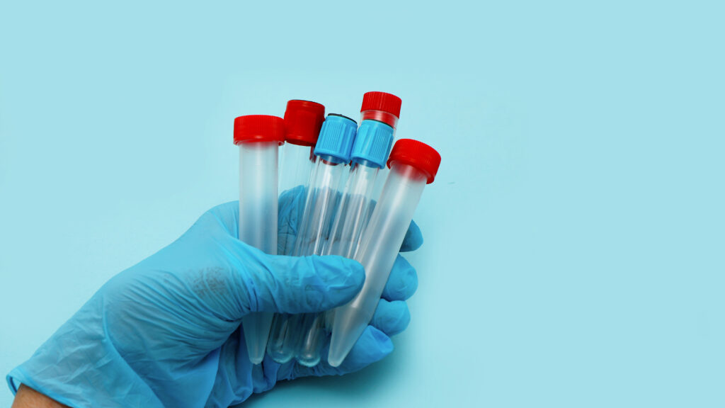 FDA seeks to regulate lab-developed tests