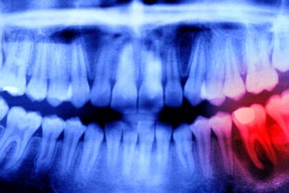 Expert Reveals a Surprising Link Between Oral Health And Your Brain : ScienceAlert