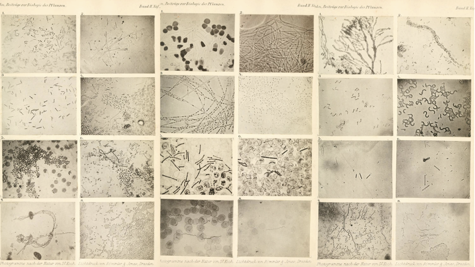 The first published photographs of bacteria.